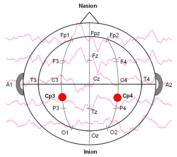 Basic Evoked Potentials