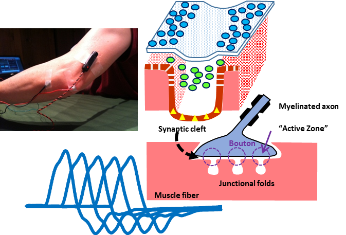 Repetitive Nerve Stimulation