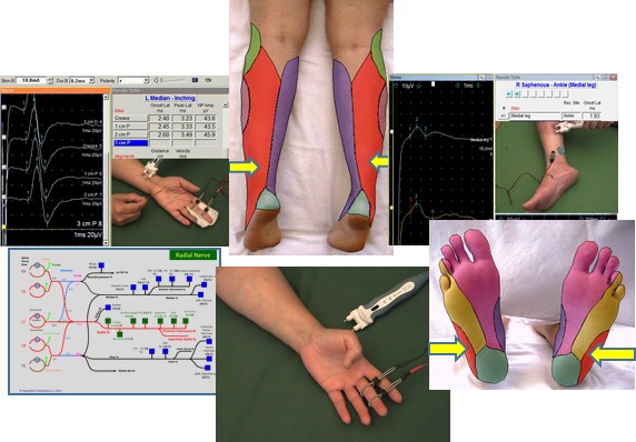 Sensory Nerve Conduction Studies (2nd Edition)